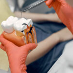 Kanal Tedavisi Sonrası Ağrı