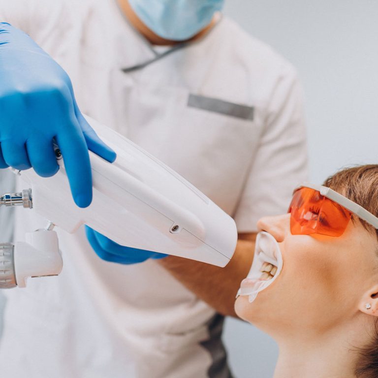 dis-beyazlatma-sonrası