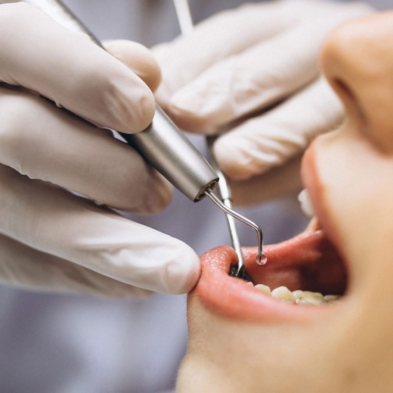 endodonti-dolgu-yapar-mı