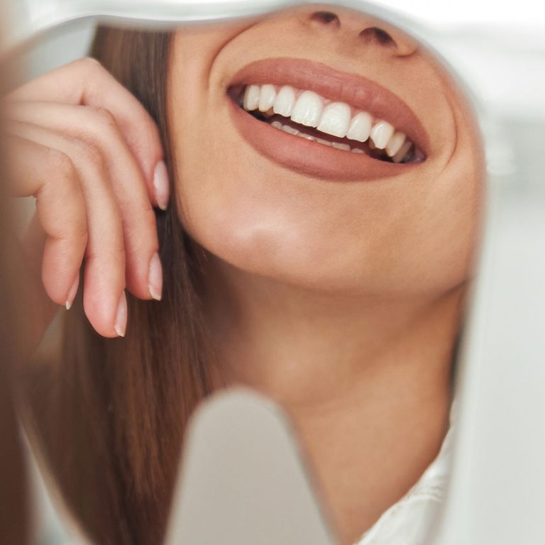 hollywood-gülüşü